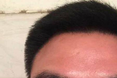 人为什么会长龙角骨