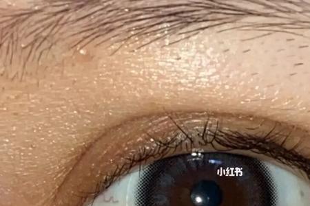 鼓着眼珠子意思