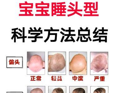 10个月宝宝标准头型