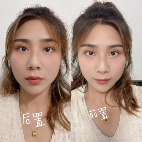 苹果手机自拍脸歪怎么解决