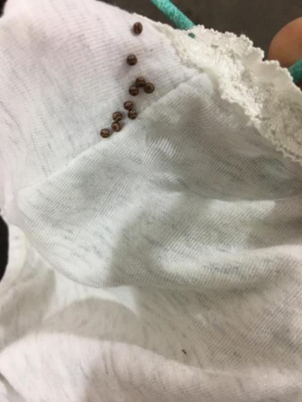 虫卵的意思