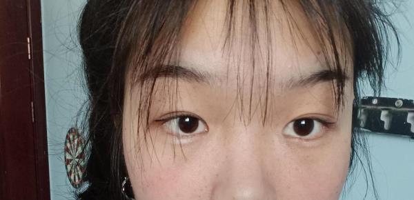 怎么看出别人是双眼皮还是单眼