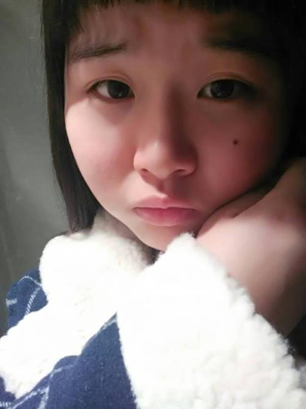 脸上有痣能报考师范学校吗
