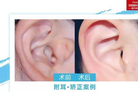 什么叫附耳草