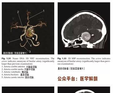 cta如何使用虚拟摄像头捕捉图像