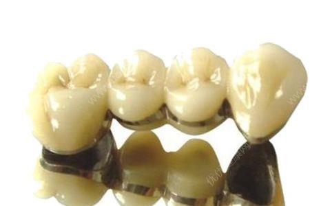 刚做的烤瓷牙重新做要收费吗