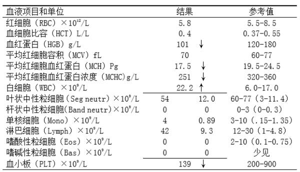 cpr比值是什么