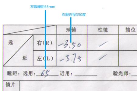 验光单怎么看储备值