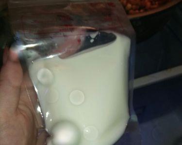 母乳热的时候有黄色的是什么