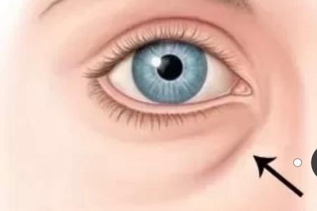 胶原蛋白释放术是什么