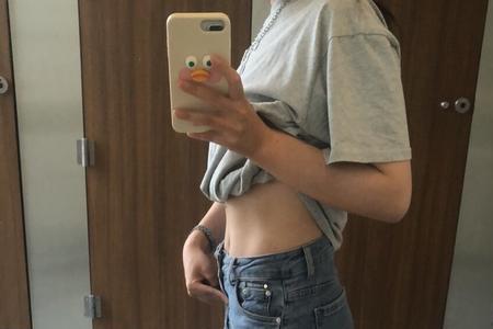 脂肪沟和马甲线的区别图片