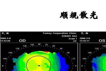 顺规散光和逆规散光配镜区别
