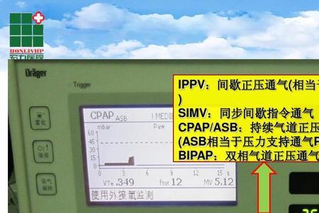 呼吸机模式和参数设置