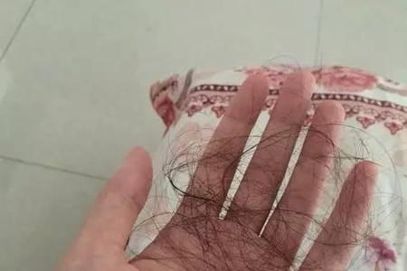 100根头发是多大的量