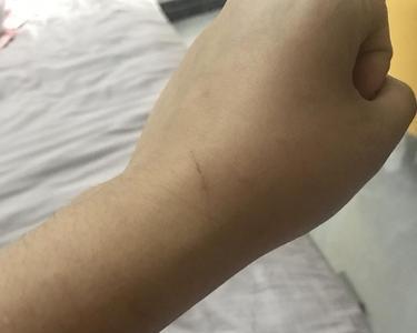 猫咬自己腿什么意思