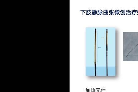 9万的射频消融术能报销多少