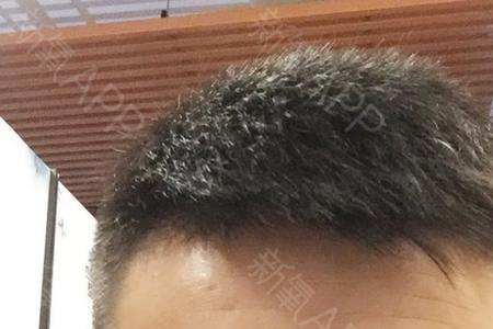 男人眉毛重代表什么