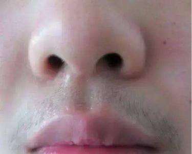 毛发旺盛的女生有什么特征
