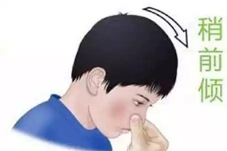 捏鼻子吸气头疼