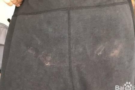 灰衣服被84消毒液染白了怎么办