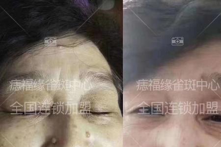 痣福缘护肤品可靠吗