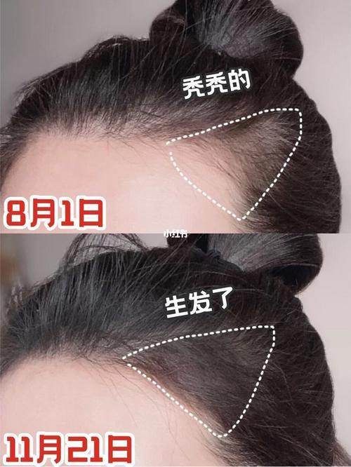 鬓角软化能维持多少时间