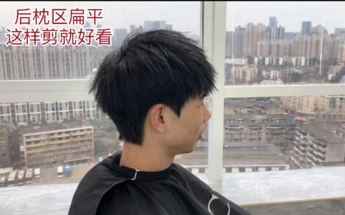 男生太阳穴凹陷适合留什么发型