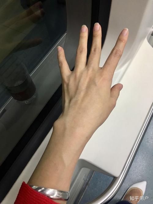 手上青筋明显是怎么回事女生