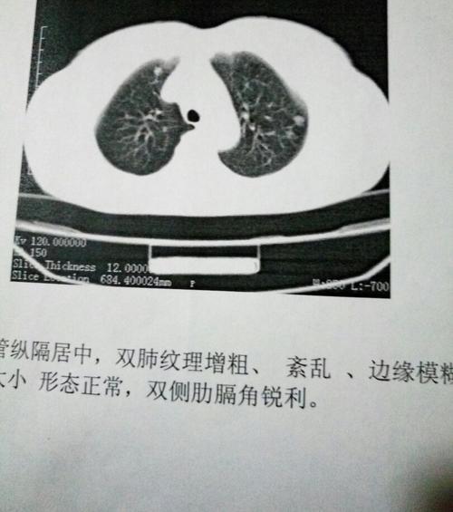请问心影稍大是什么意思