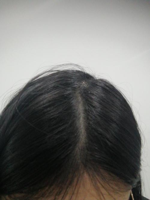 头发变黑最佳方法