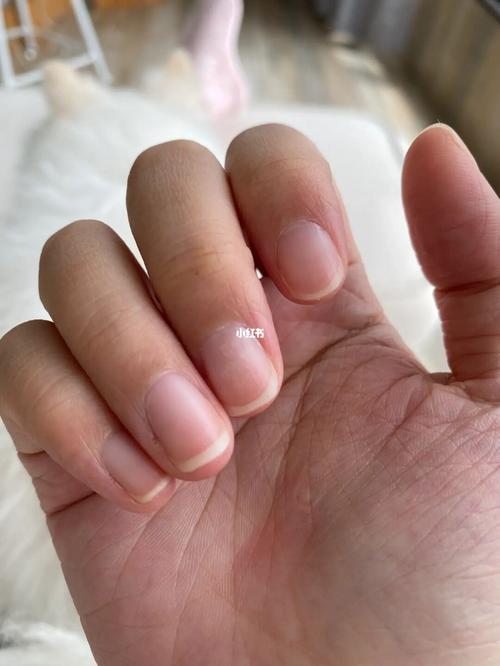 女子中指没指甲是什么意思