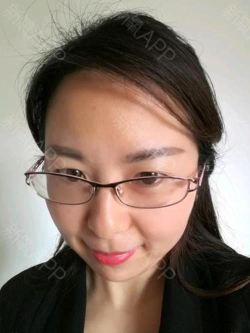 什么叫脱屏