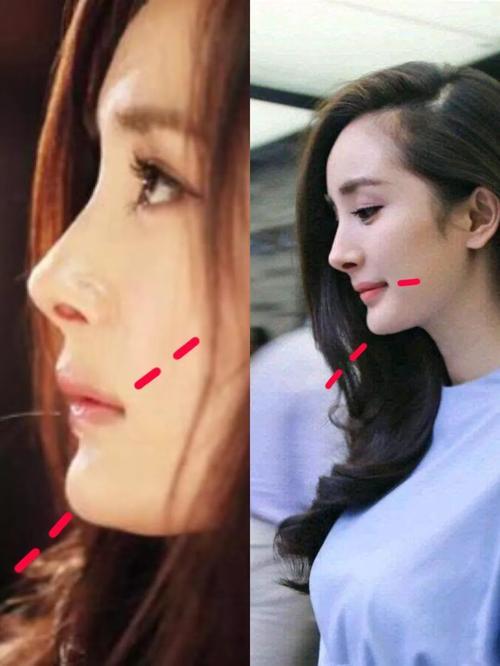 为什么嘴角两边有轮廓