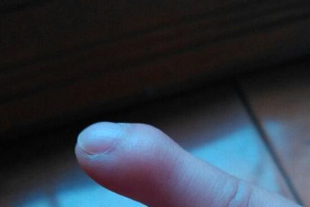 小拇指短怎么拍照