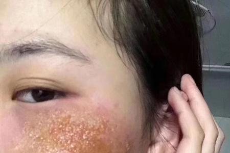 雅诗兰黛粉底液会变激素脸吗