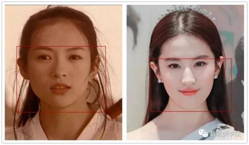 女星脸垮是怎么回事