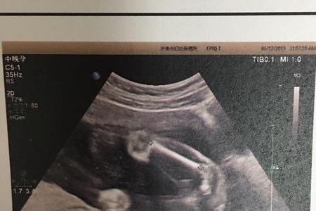 月份大了还能看清男女吗