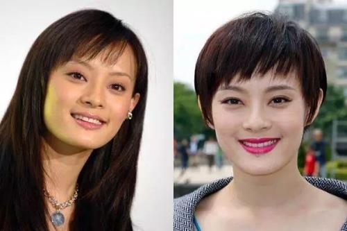 为什么刚长出来的短发也会掉