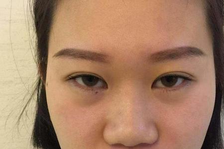 低鼻梁和塌鼻梁的区别