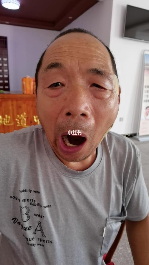 十六个月宝宝为什么说话嘴会歪