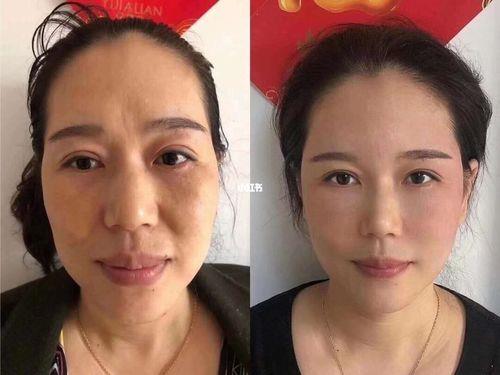服装拉皮是什么意思