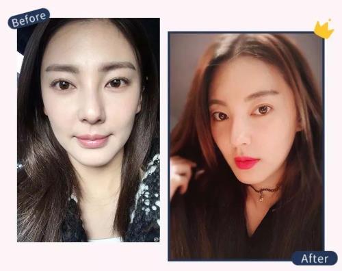 为什么自拍嘴是歪的