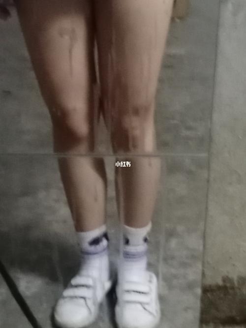 男生大腿太粗怎么办怎么减