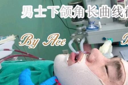 下颌骨俗称是什么