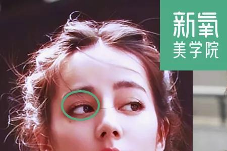 眼眶凹进去还是突出来好看