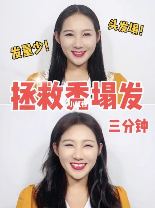 头发一边塌一边高怎么办