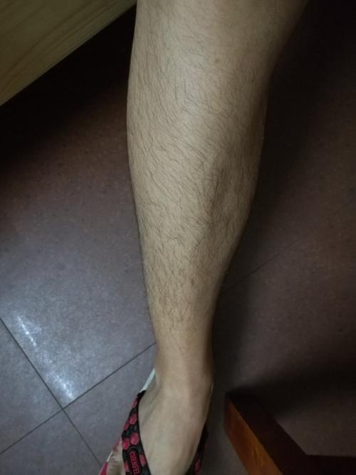穿短裤腿毛会变长吗