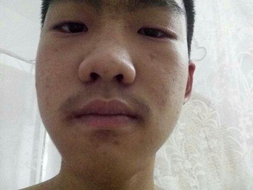 为什么下巴的胡子先白