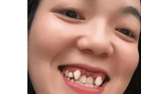 为啥男生不喜欢有虎牙的女生