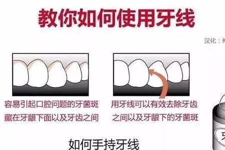 为什么剔牙要捂嘴